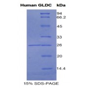 SDS-PAGE analysis of Human Glycine Dehydrogenase Protein.