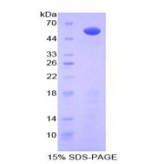 SDS-PAGE analysis of Human Glypican 3 Protein.