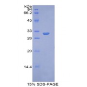 SDS-PAGE analysis of Human Glypican 4 Protein.