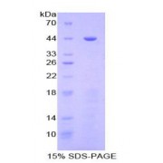 SDS-PAGE analysis of Human Golgi Protein 73 Protein.