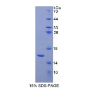 SDS-PAGE analysis of Human Pro-GNRH1 Protein.