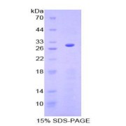 SDS-PAGE analysis of recombinant Human Granulin Protein.