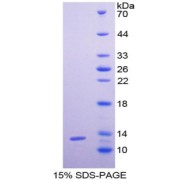 SDS-PAGE analysis of Human GCP2 Protein.