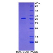 SDS-PAGE analysis of Human GAS2 Protein.