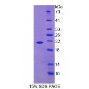 SDS-PAGE analysis of Human GAS6 Protein.