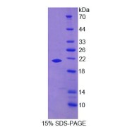 SDS-PAGE analysis of Human GAS6 Protein.