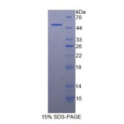 SDS-PAGE analysis of recombinant Mouse GAS6 Protein.