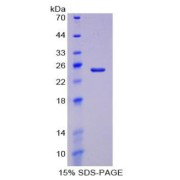 SDS-PAGE analysis of Pig Haptoglobin Protein.