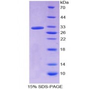 SDS-PAGE analysis of Human HPR Protein.