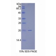 SDS-PAGE analysis of Human HSP10 Protein.