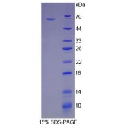 SDS-PAGE analysis of recombinant Human HSPD1 Protein.