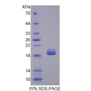 SDS-PAGE analysis of recombinant Rat Sonic Hedgehog Protein (SHH) Protein.