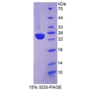 SDS-PAGE analysis of Human Heme Oxygenase 1 Protein.