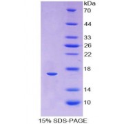 SDS-PAGE analysis of Human Hemoglobin alpha 1 Protein.