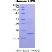 SDS-PAGE analysis of Human Hemopexin Protein.