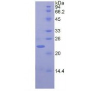 SDS-PAGE analysis of recombinant Human Syndecan 2 (SDC2) Protein.