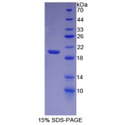 SDS-PAGE analysis of Human Heparanase Protein.