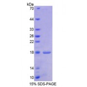SDS-PAGE analysis of Human HBEGF Protein.