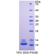 SDS-PAGE analysis of recombinant Human HNRPA2B1 Protein.