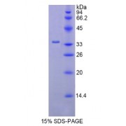 SDS-PAGE analysis of Human Hexokinase 2 Protein.