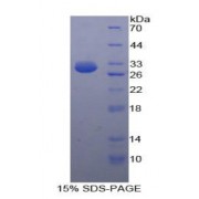 SDS-PAGE analysis of Human HK3 Protein.