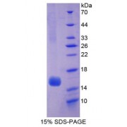 SDS-PAGE analysis of recombinant Human Hexosaminidase B beta Protein.