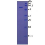 SDS-PAGE analysis of recombinant Rat KNG1/HMWK Protein.
