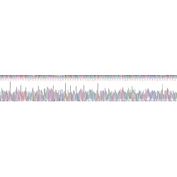Human Hornerin (HRNR) Protein