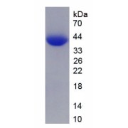 SDS-PAGE analysis of recombinant Human Hyaluronoglucosaminidase 1 (HYAL1) Protein.