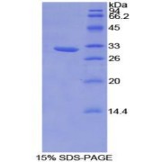 SDS-PAGE analysis of Rat Hydroxyacid Oxidase 1 Protein.