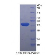 SDS-PAGE analysis of Human HMGCS Protein.
