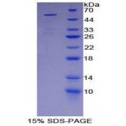SDS-PAGE analysis of Human HPRT1 Protein.