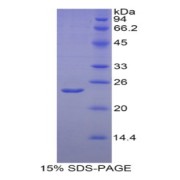 SDS-PAGE analysis of Human HIF2a Protein.
