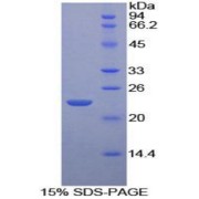 SDS-PAGE analysis of Mouse Iga Protein.