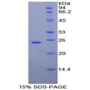 SDS-PAGE analysis of Human Iga Protein.