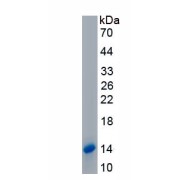 SDS-PAGE analysis of recombinant Human Inhibin Beta E Protein.