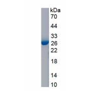 SDS-PAGE analysis of Mouse NF-kappa-B Inhibitor Beta (NFKBIB) protein.