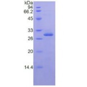 SDS-PAGE analysis of recombinant Human IkBe Protein.