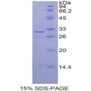 SDS-PAGE analysis of Human IGF2BP2 Protein.