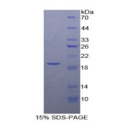 SDS-PAGE analysis of Cow Insulin Like Growth Factor Binding Protein 3 (IGFBP3) Protein.