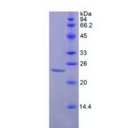 SDS-PAGE analysis of recombinant Mouse IAP/CD47 Protein.