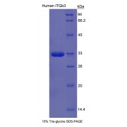SDS-PAGE analysis of recombinant Human Integrin beta 3 Protein.