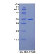 SDS-PAGE analysis of Mouse ITIH1 Protein.