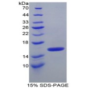 SDS-PAGE analysis of recombinant Human ITIH4 Protein.