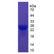 SDS-PAGE analysis of recombinant Mouse ITIH5 Protein.