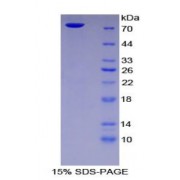 SDS-PAGE analysis of Human Intercellular Adhesion Molecule 1 Protein.