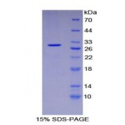 SDS-PAGE analysis of Human Intercellular Adhesion Molecule 3 Protein.