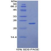SDS-PAGE analysis of Human Intercellular Adhesion Molecule 4 Protein.