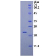 SDS-PAGE analysis of recombinant Chicken Interferon beta Protein.