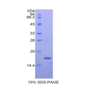 SDS-PAGE analysis of Rat Interferon gamma Protein.